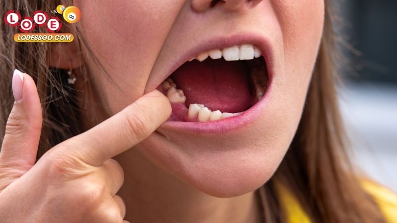 Mơ Thấy Mất Răng